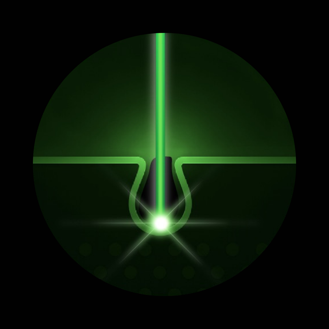 Hair removal laser working on a hair follicle 